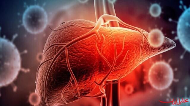  تحلیل ایران -درمان کبد چرب با مصرف خودسرانه دارو مختل می‌شود
