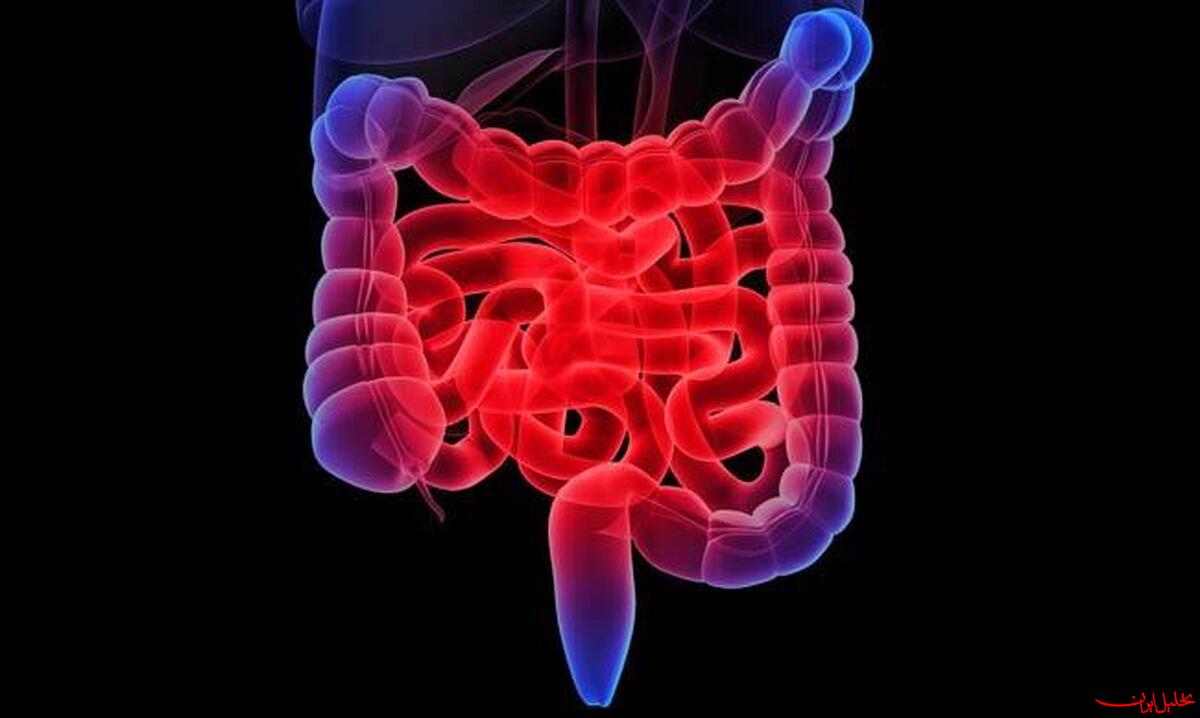  تحلیل ایران -جلوگیری از چاقی با مسدود کردن یک آنزیم کلیدی در روده