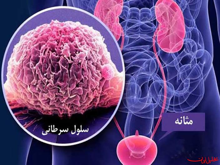  تحلیل ایران -فراخوان فناوری طرح توسعه دانش فنی بیوبانک ارگانویید و تومورویید