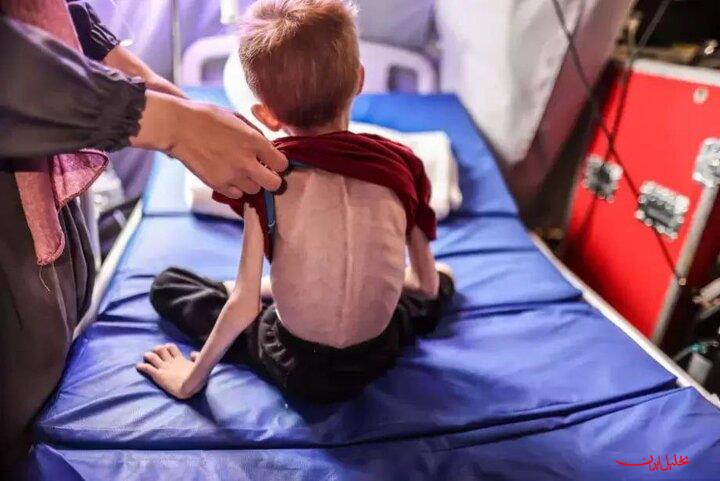  تحلیل ایران -وزارت بهداشت غزه: ۶۵۰ هزار کودک در آستانه مرگ هستند