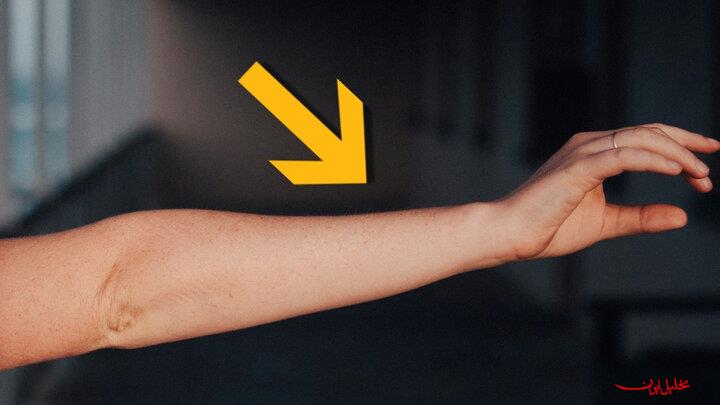  تحلیل ایران -ردپای تکامل انسان‌ها در یک رگ اضافه دست