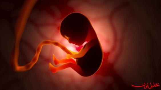  تحلیل ایران -ساخت رحم مصنوعی با فناوری نانو در ایران