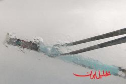  تحلیل ایران -فریز جنین چیست و برای چه کسانی توصیه می‌شود؟