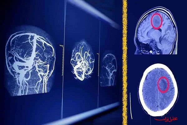 پیش بینی آینده رادیولوژیست‌ها باوجود هوش مصنوعی