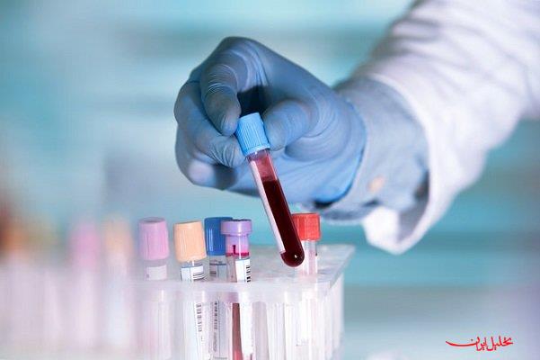  تحلیل ایران -خطر HPV کاملا جدی است